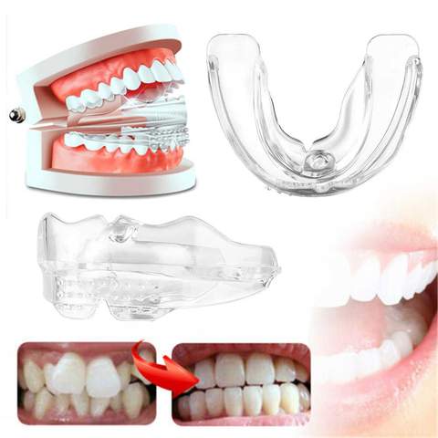 Aparelho Alinhamento Dental Ortodôntico G3P20 - Alinhamento Dental Casa Tech Loja 
