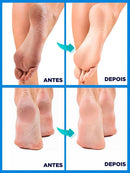 DermaPé - Removedor Automático de Rachaduras e Calos G7P21 - DermaPé - Removedor Automático de Rachaduras e Calos Casa Tech Loja 