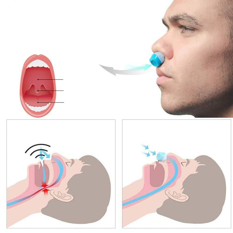 Dispositivo Nasal Anti-Ronco BES06 - Dispositivo Nasal Anti-Ronco Casa Tech 
