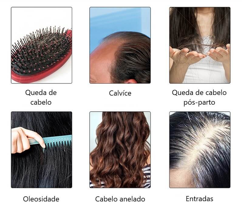Escova a Laser – Terapia para Crescimento Capilar HairRise™ G6P20 - Escova a Laser – Terapia para Crescimento Capilar HairRise™ Casa Tech Loja 