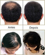 Escova a Laser – Terapia para Crescimento Capilar HairRise™ G6P20 - Escova a Laser – Terapia para Crescimento Capilar HairRise™ Casa Tech Loja 