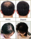 Escova a Laser – Terapia para Crescimento Capilar HairRise™ G6P20 - Escova a Laser – Terapia para Crescimento Capilar HairRise™ Casa Tech Loja 