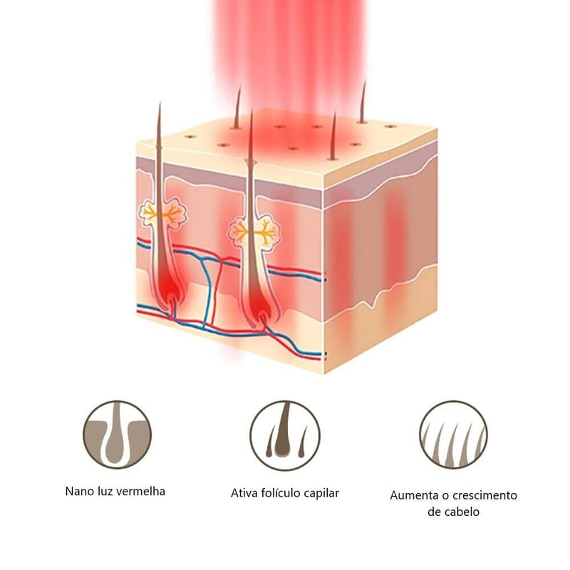 Escova a Laser – Terapia para Crescimento Capilar HairRise™ G6P20 - Escova a Laser – Terapia para Crescimento Capilar HairRise™ Casa Tech Loja 