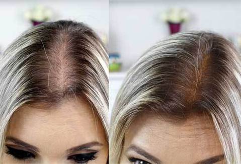 Escova Alisadora Ultra Hair - Massagem a Laser para Crescimento Capilar G3P19 - Escova Ultra Hair Casa Tech Loja 