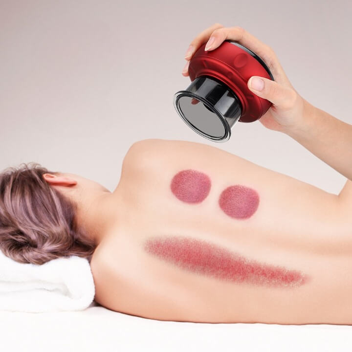 Massageador à Vácuo DermaCup G7P15 - Massageador à Vácuo DermaCup Casa Tech Loja 