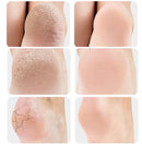 Palmilha Ortopédica para Fascite Plantar, Esporão Ósseo no Calcanhar TER17 - Palmilha Ortopédica para Fascite Plantar, Esporão Ósseo no Calcanhar Casa Tech Loja 